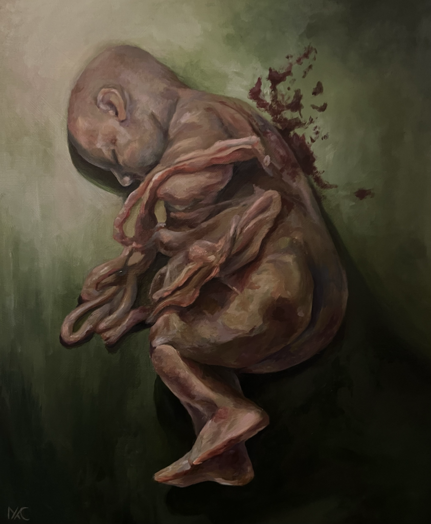 Entre útero y tumba